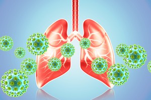 Influenza and pneumonia, a dangerous combination